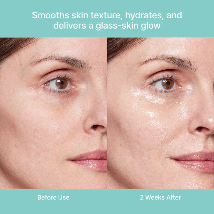 Turnover Ampoule