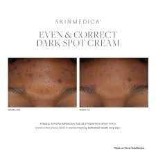 Even & Correct Dark Spot Cream