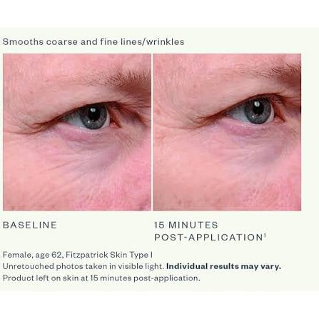 Skinmedica Intant Bright Eye Cream