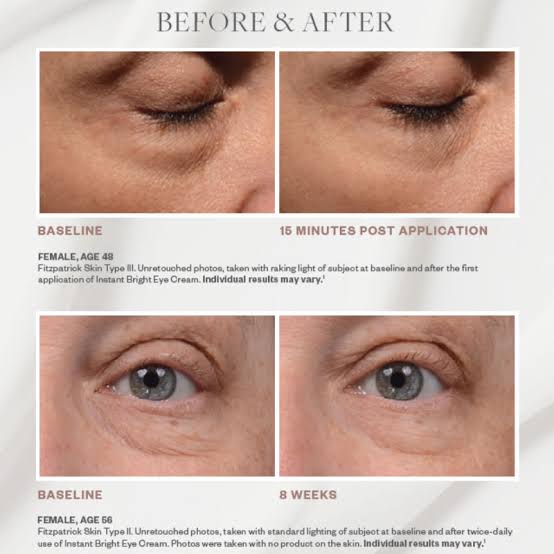Skinmedica Intant Bright Eye Cream